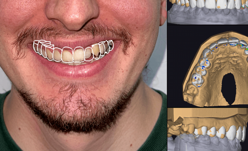 Smile Creator part of a day to day protocol 1 - Smile Creator, part of a day-to-day protocol!